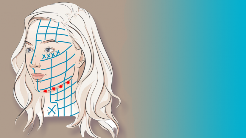 BeautyBiowave Cielený ultrazvuk HIFU s RF a LED