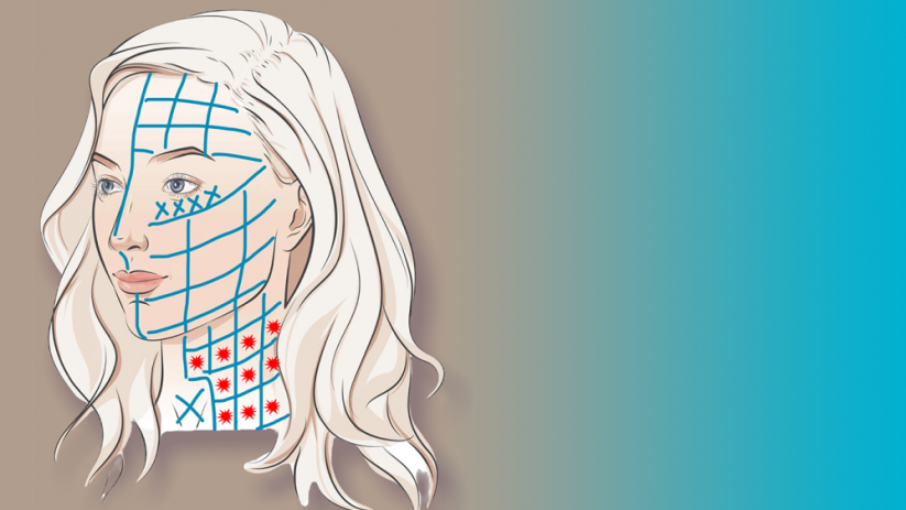BeautyBiowave Cílený ultrazvuk HIFU s RF a LED