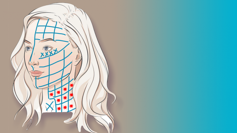 BeautyBiowave Cielený ultrazvuk HIFU s RF a LED