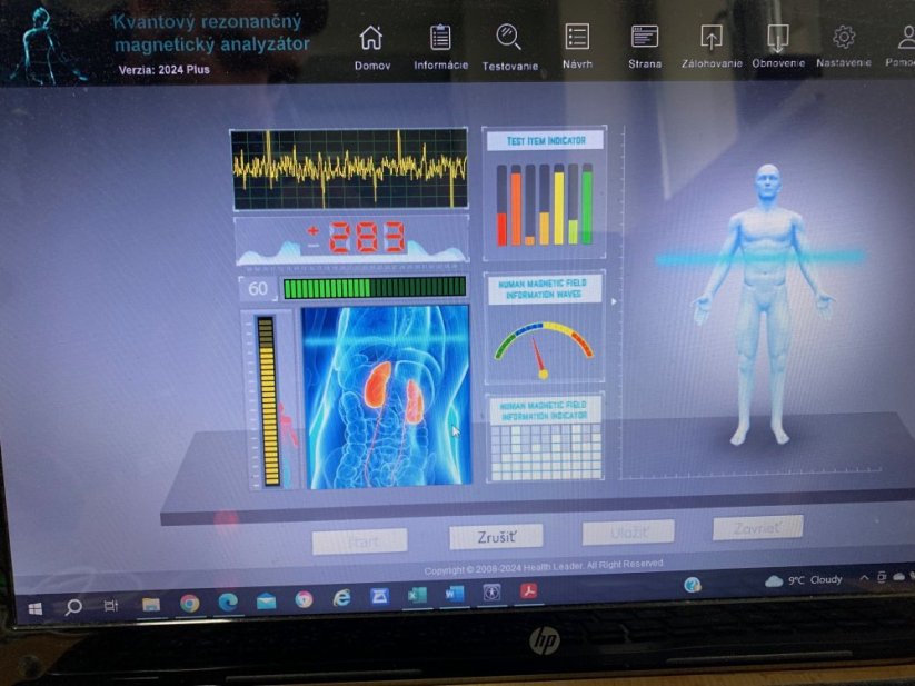 Analyzátor zdravotního stavu (QMRA - kvantový magnetický rezonanční analyzátor)