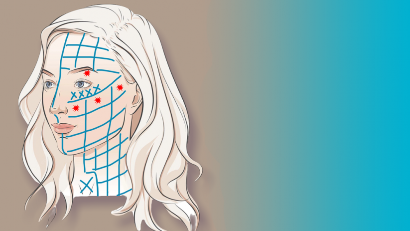 BeautyBiowave Cílený ultrazvuk HIFU s RF a LED