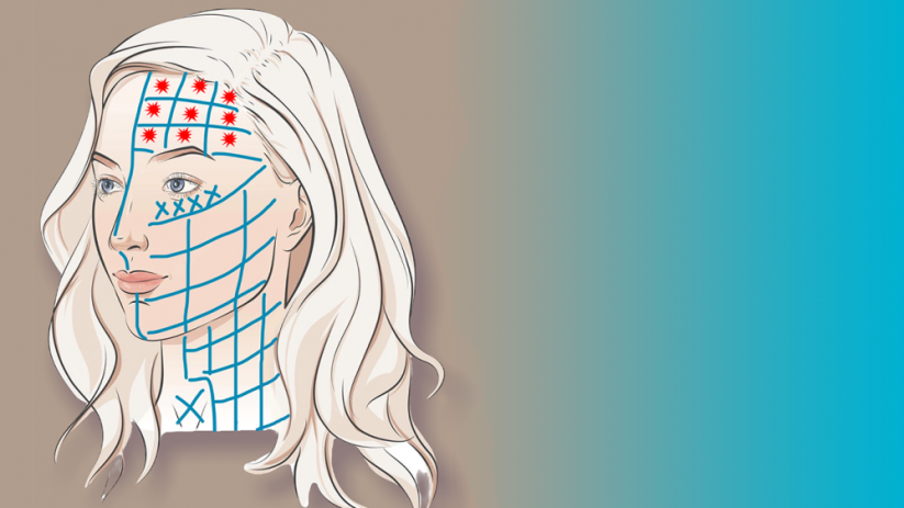 BeautyBiowave Cílený ultrazvuk HIFU s RF a LED