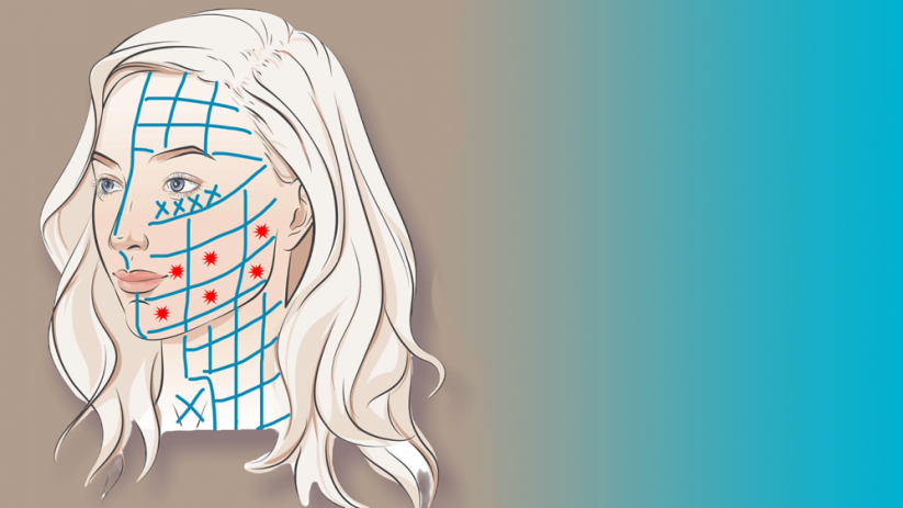BeautyBiowave Cílený ultrazvuk HIFU s RF a LED